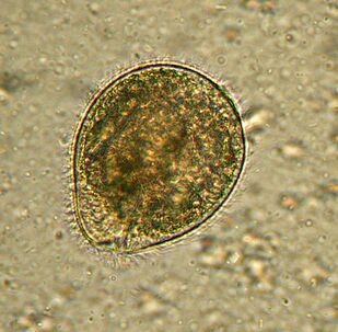 Balantidium is the largest parasitic protozoan