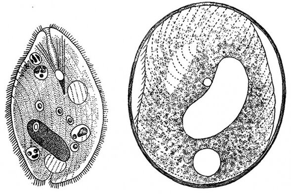 balantidia parasitic protozoa