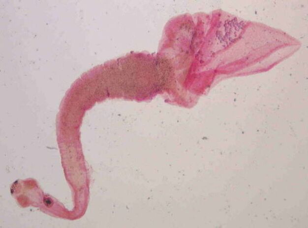 human body pig tapeworm